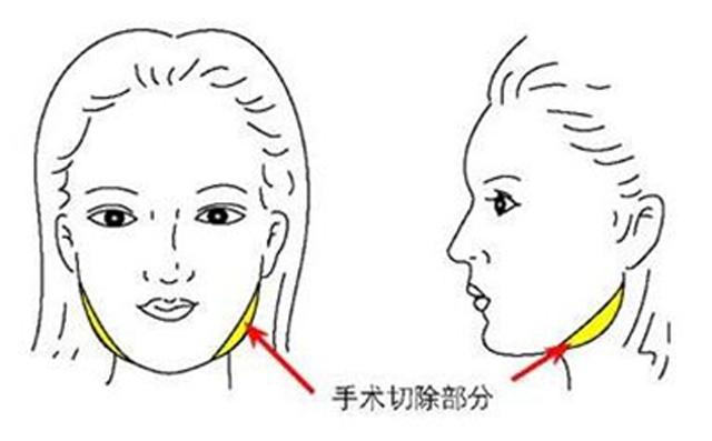 宽脸瘦脸方法公认超有效,50多岁小脸瘦脸适合扎什么发型