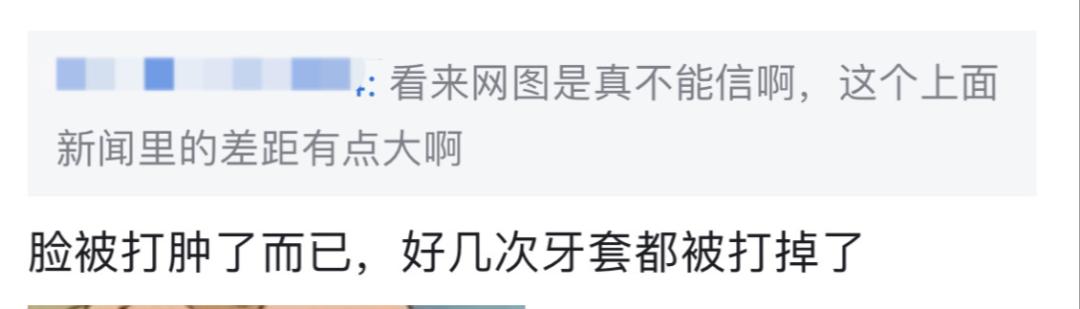 这样的“*力暴**萝莉”,丑吗?