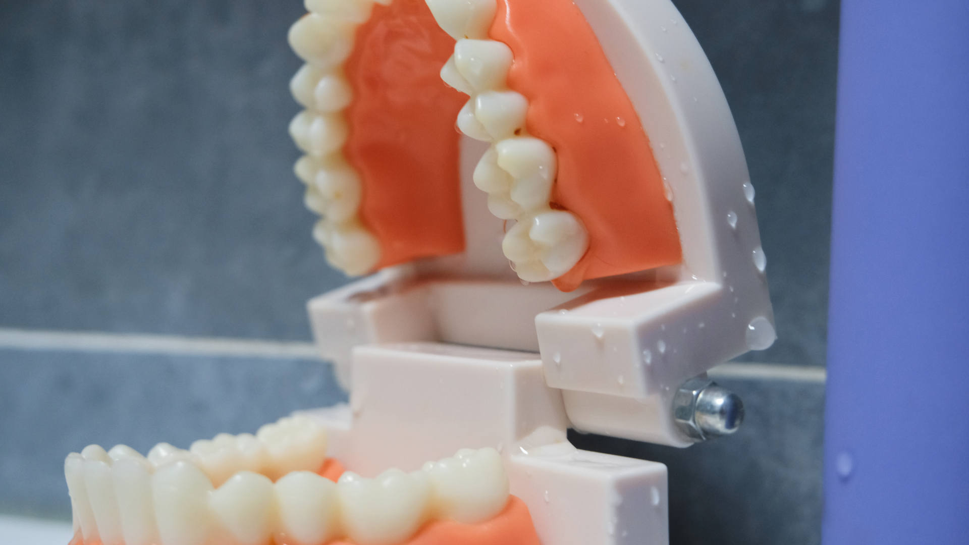 种植牙推荐电动牙刷,根据自己的牙选择电动牙刷