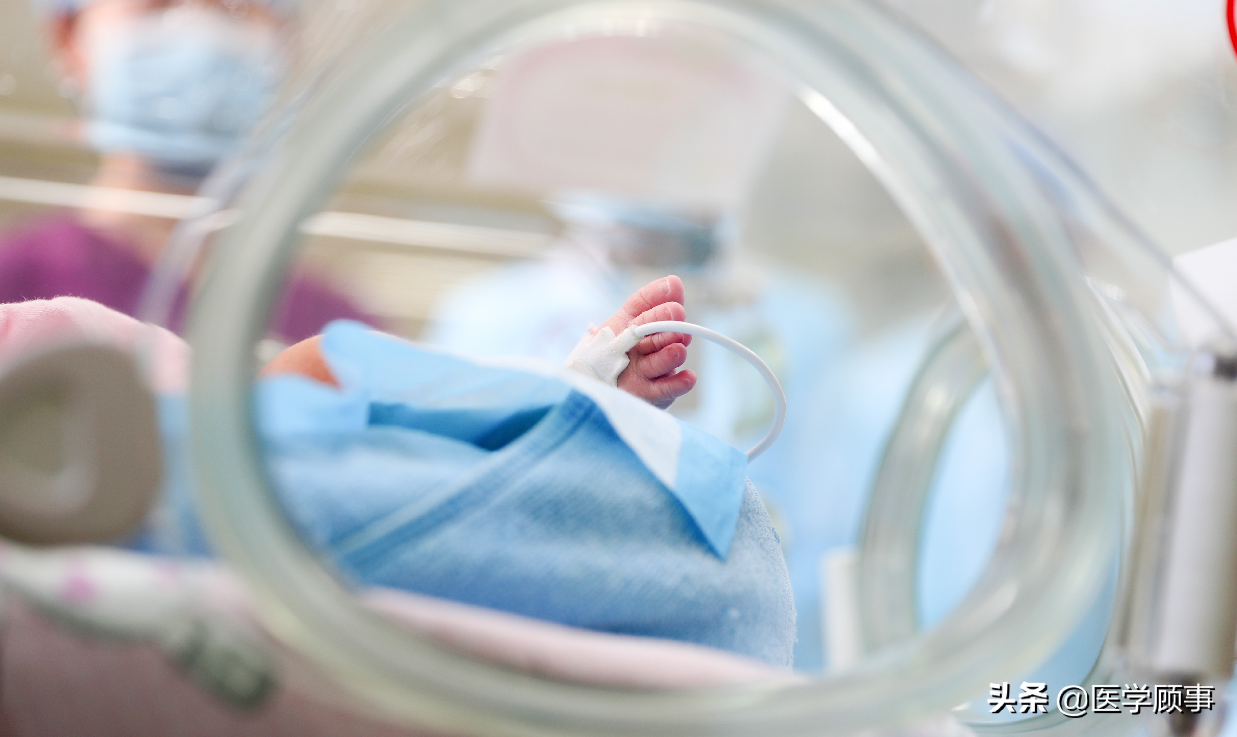 pdca在新生儿窒息复苏中的应用,重症医学科的pdca项目有哪些