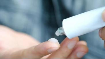 鼻子黑头怎么彻底解决,鼻子黑头最简单的消除方法