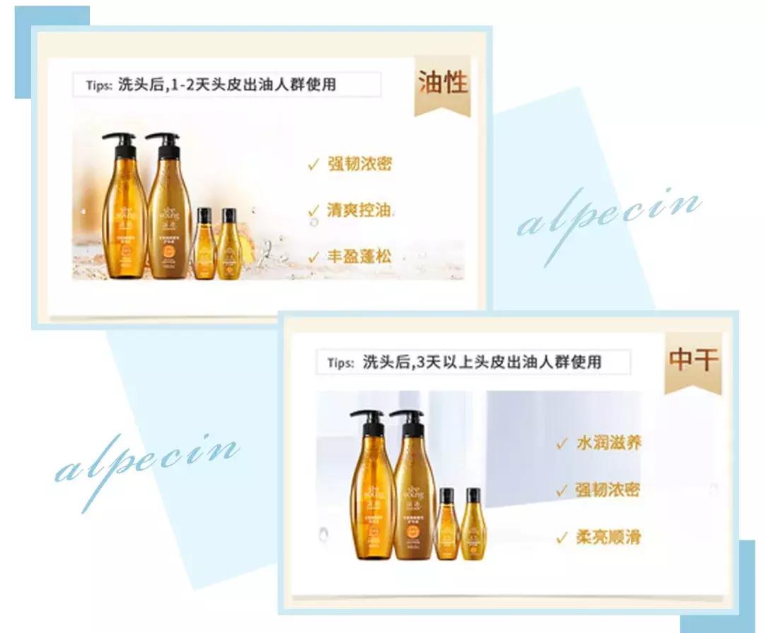 赵丽颖秃头照,赵丽颖秃顶原因