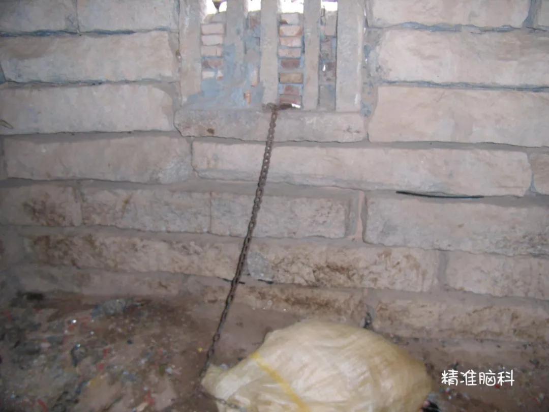 精神分裂症多长时间恢复正常上班,孩子得了精神分裂症怎么帮他恢复