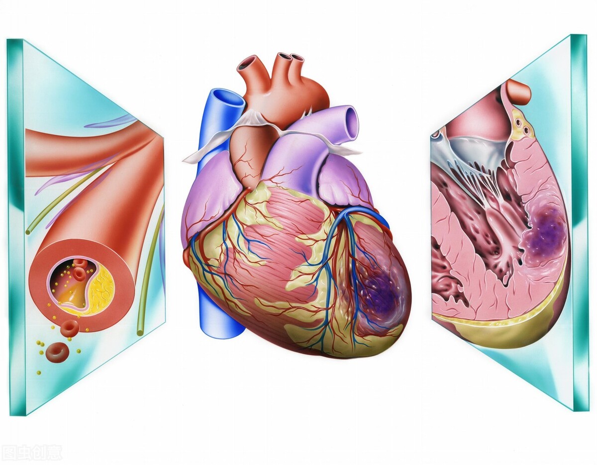 胃痛一个月后突发心梗,大夫心梗误诊胃病致死