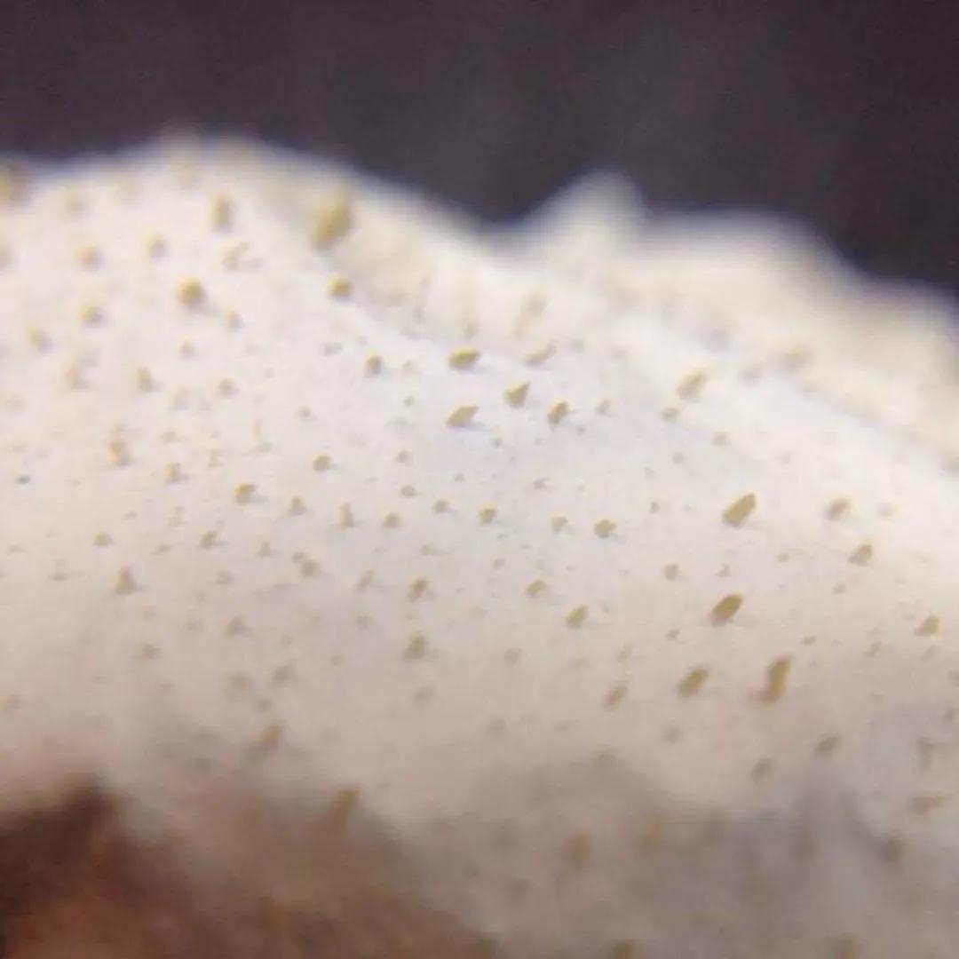 每到换季就会爆痘,换季时爆痘