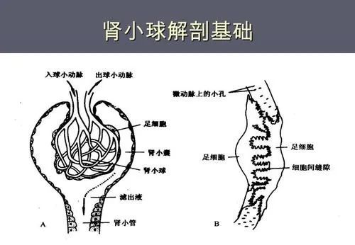 你知道肥胖也分类型吗,心源性水肿和肾性水肿的区别