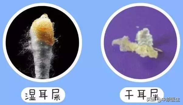 2岁男孩弄耳屎出血怎么办,2岁多抓耳屎出血了