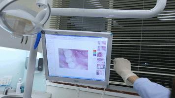 窝沟封闭没了会怎样,小孩有蛀牙可以窝沟封闭吗