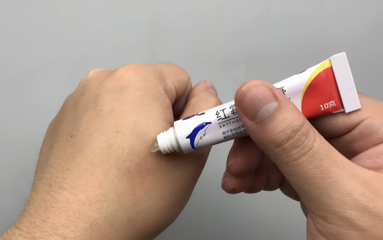 红霉素软膏用于眼睛会有什么后果,红霉素软膏对眼睛有什么副作用