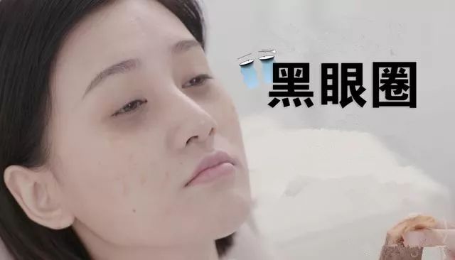9个日常生活去黑眼圈小妙招,比较严重的黑眼圈怎么处理
