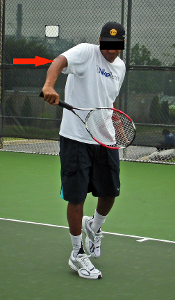 胳膊肘疼俗称网球肘怎么止痛,胳膊肘筋疼不敢伸直挂什么科