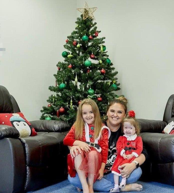 2岁女孩基因突变长得像80岁老人,2个孩子患罕见遗传病