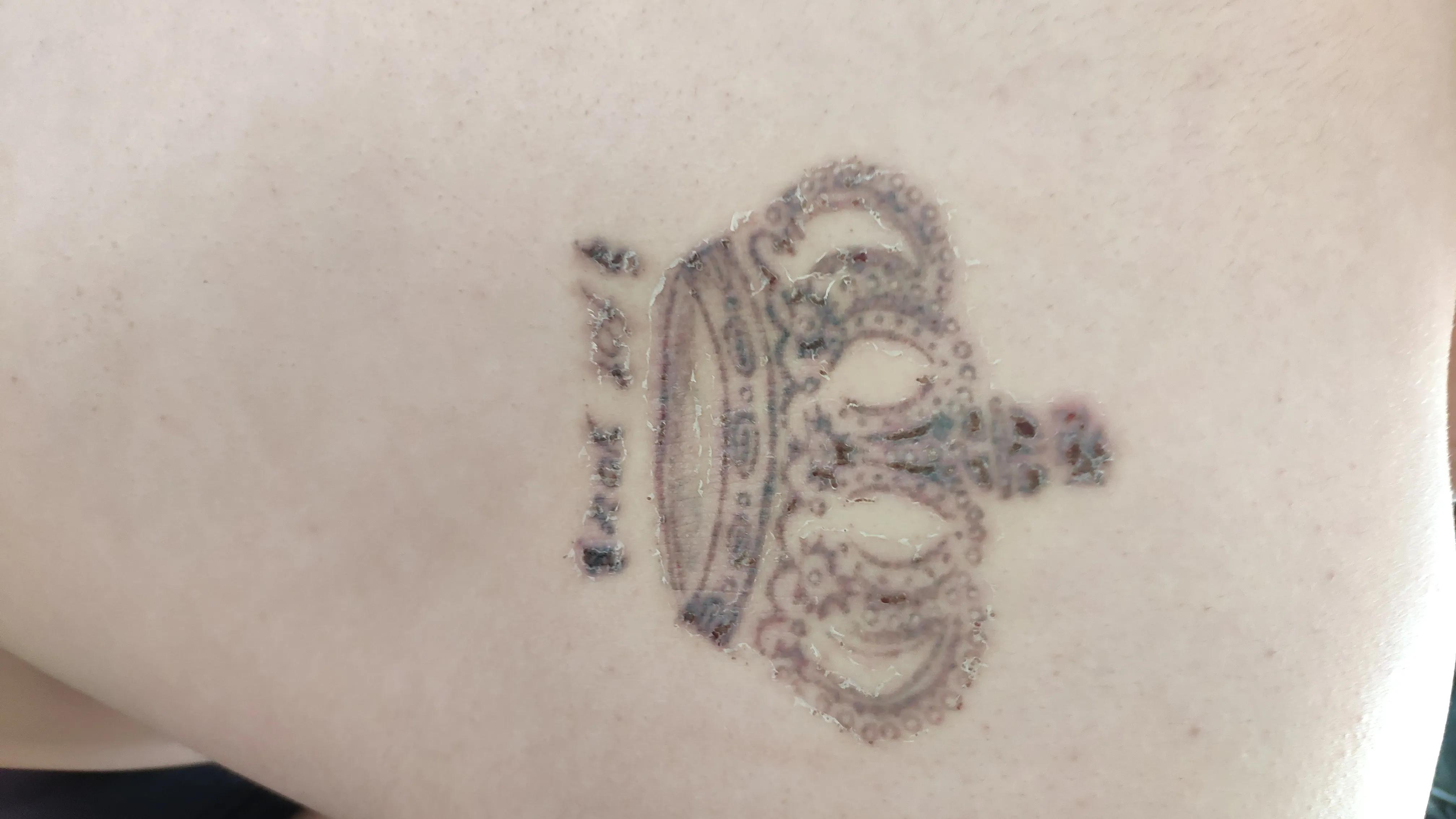 洗纹身一次比一次疼的轻吗,洗纹身一次的效果