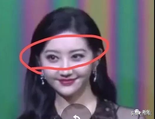 景甜修复之后的双眼皮是多宽,景甜修复后的双眼皮多宽