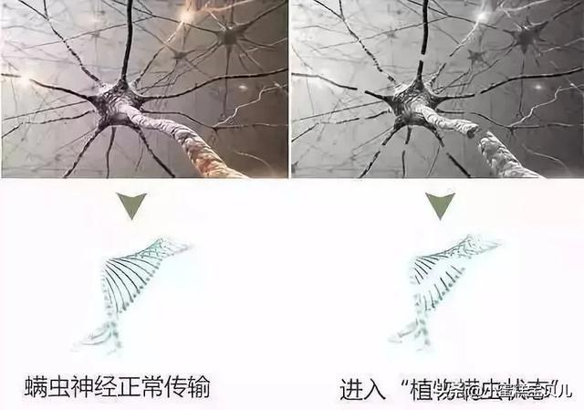 床单久睡不晒螨虫“成堆”?教你1招,不用洗不用晒,轻松除螨虫