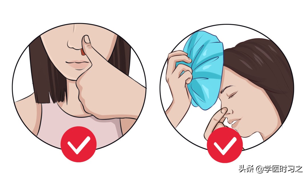 怎么治鼻出血的秘方,秋季小儿鼻出血的防治转载