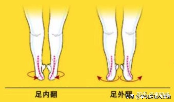 足内翻如何通过调整走路姿势改正,纠正足内翻教你一招