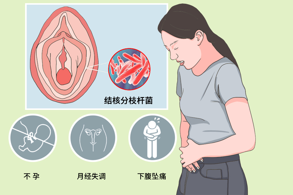 女性得了结核,女性有结核能做试管吗