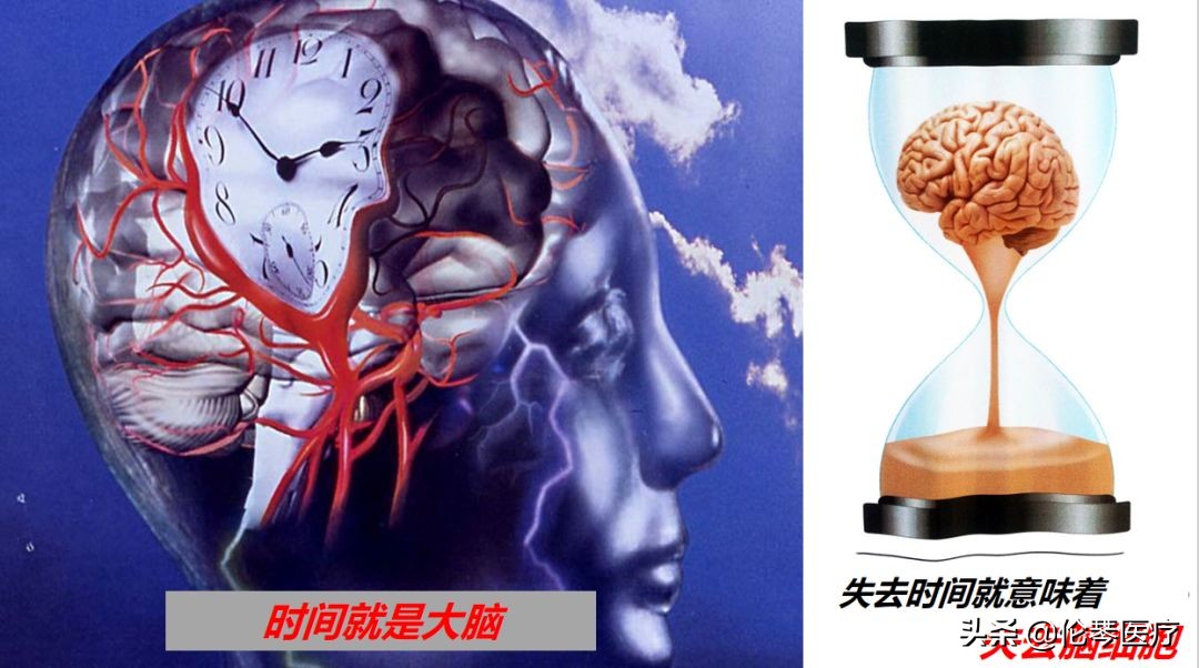 伦琴医疗核心专家王悍教授:脑中风是怎么回事,如何预防与治疗?