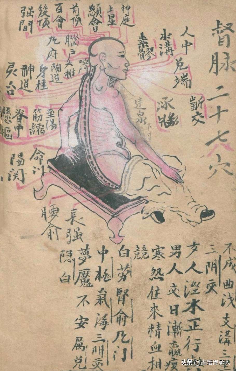 中医针刺放血疗法书,中医古籍阴阳针