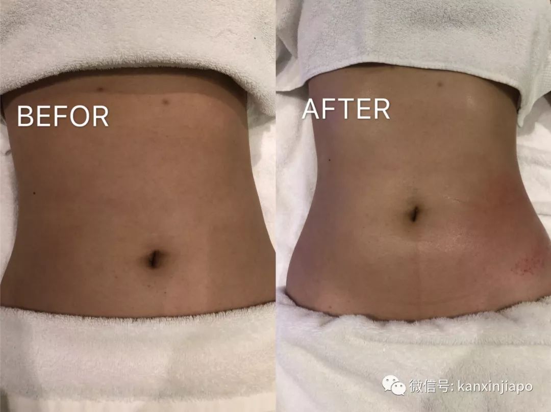 每周一次精准有效的皮肤管理,选对护肤方法让你做靓丽女神