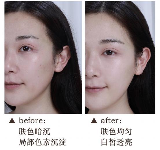 玫琳凯夏季护肤,夏天别乱用护肤品