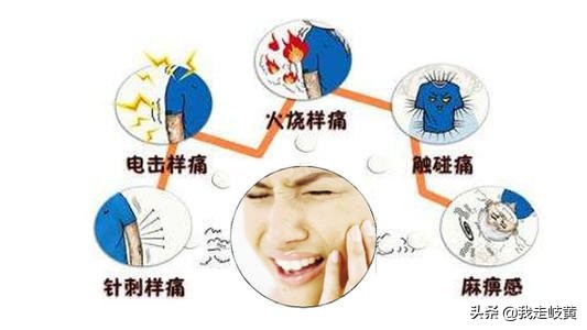 三叉神经痛挂中医什么科,中医三叉神经痛中药配方