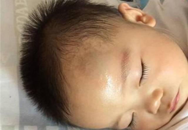 宝宝磕到头去医院查什么,小孩不小心磕到头一定要去医院吗