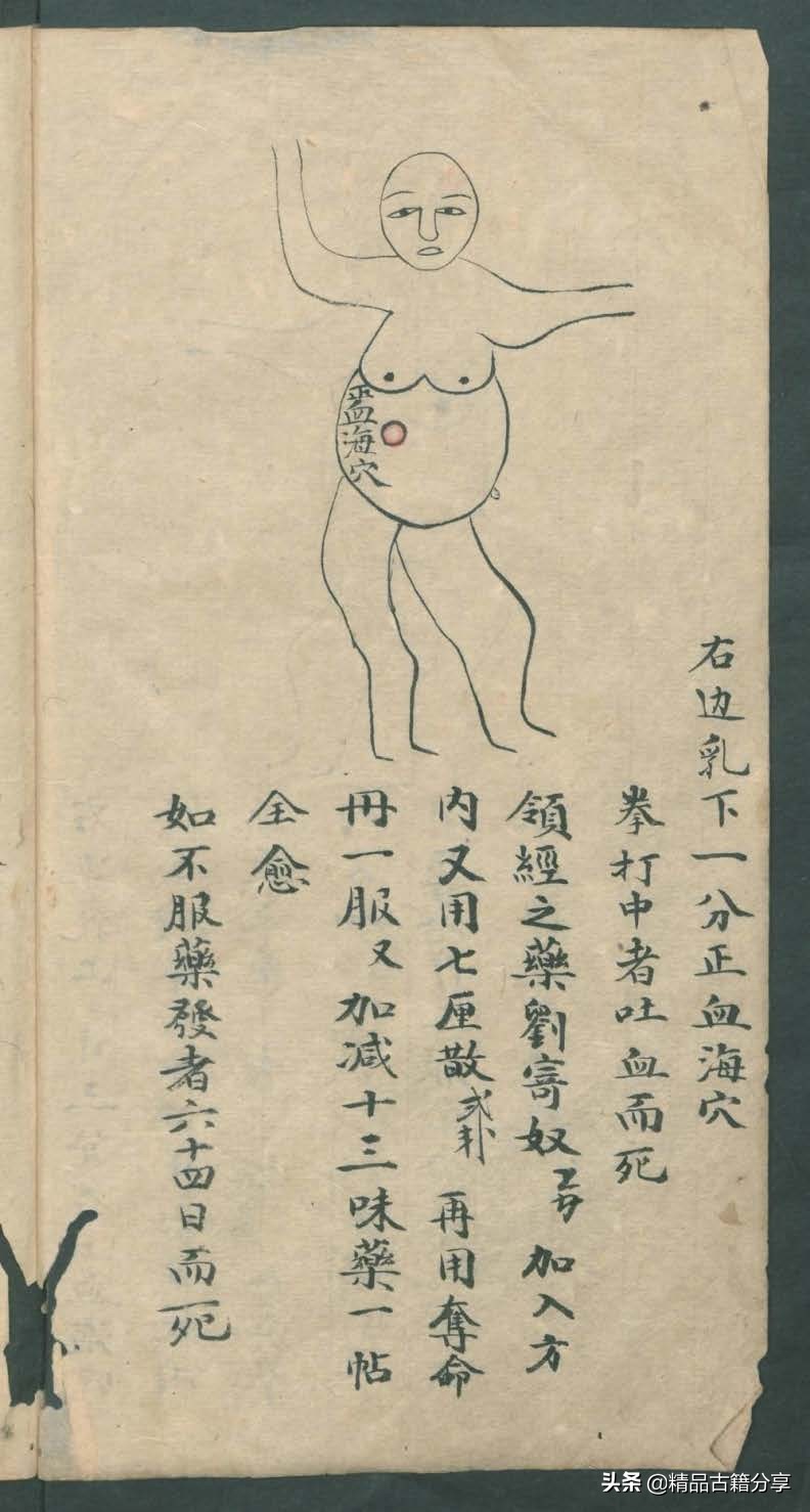 中医类抄本跌打损伤方面的医书欢迎阅读