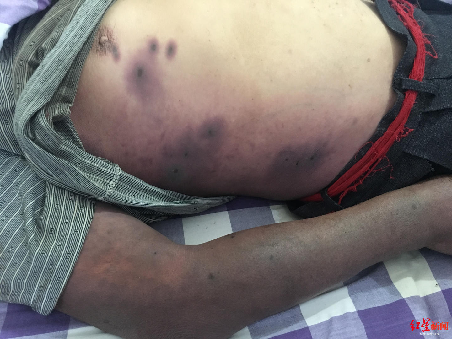 被胡蜂蜇死的养蜂人,野蜂蜂巢被摘无家可归发狂蜇死人