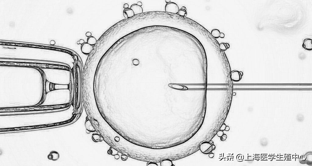 单精注射对卵泡有什么要求,卵子还没成熟就不能做单精注射吗