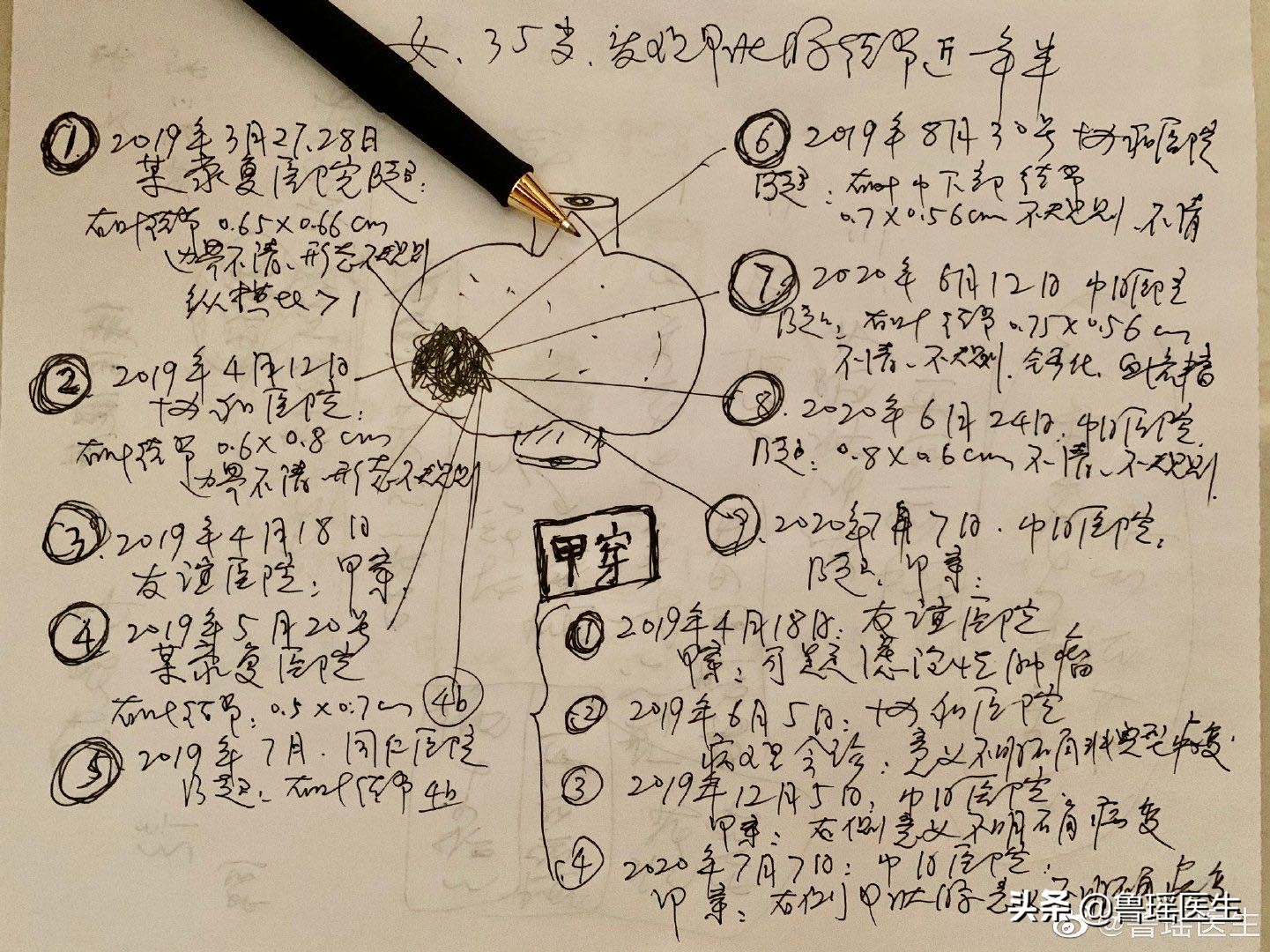 做b超一定能发现甲状腺结节吗,多次b超对结节有刺激吗