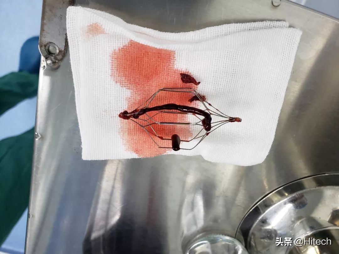 惊心动魄的救援行动,惊心动魄救援行动