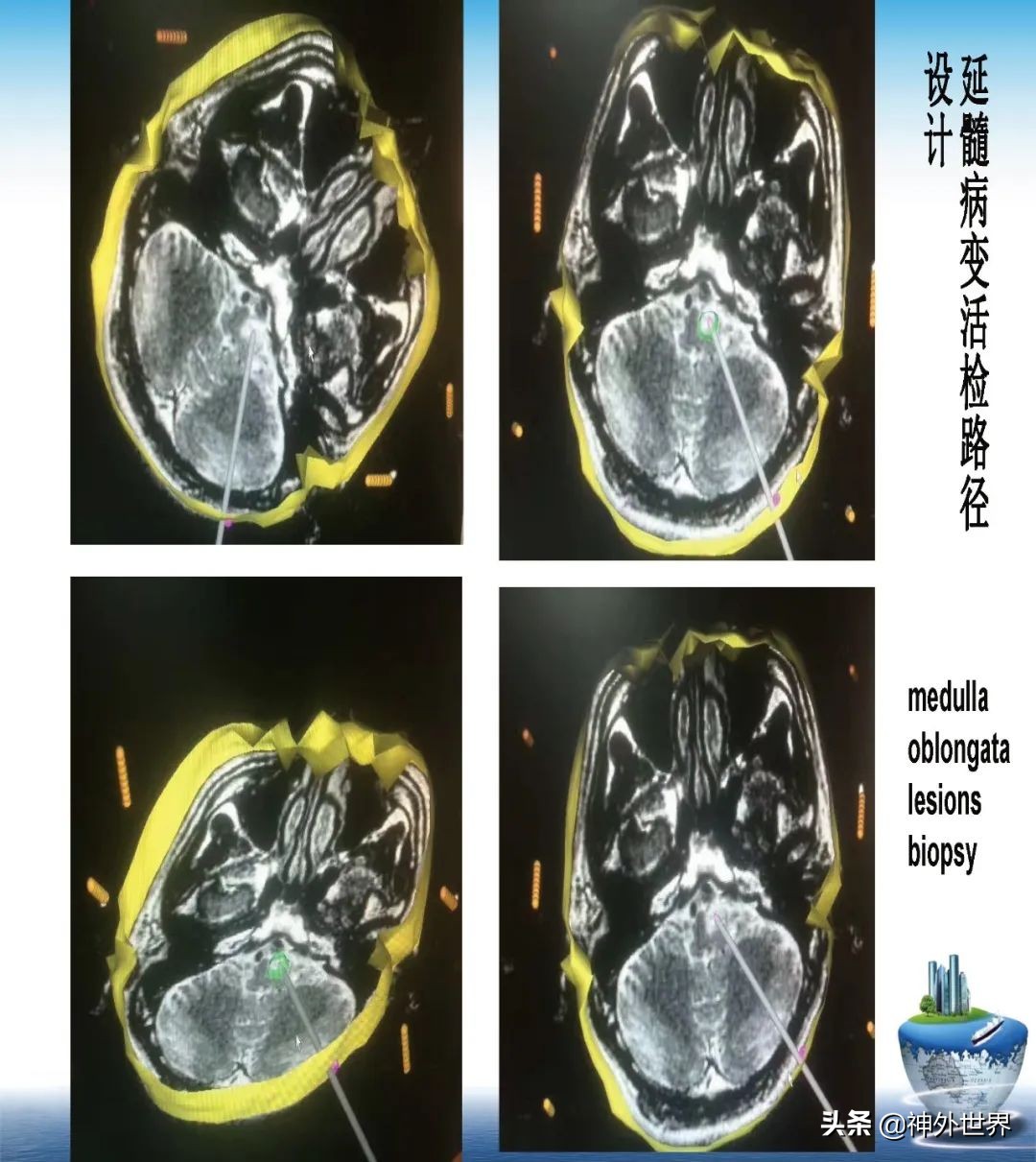 宣武医院神经外科王亚明祖籍,北京宣武医院神经科专家王亚明