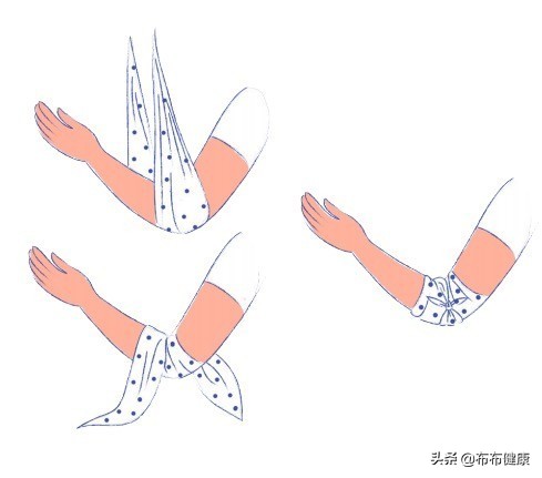 专家级指导:外伤后如何包扎伤口