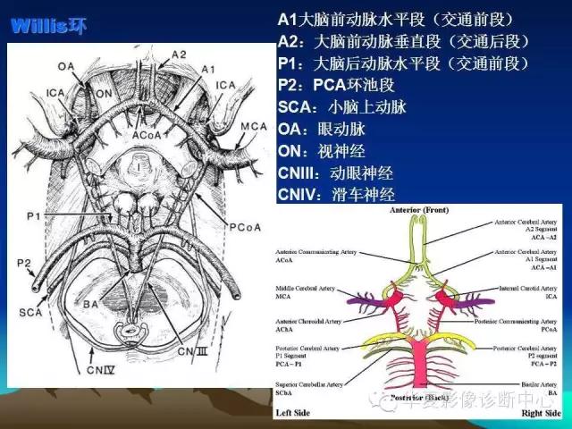小脑血管解剖分段,脑血管影像解剖讲解