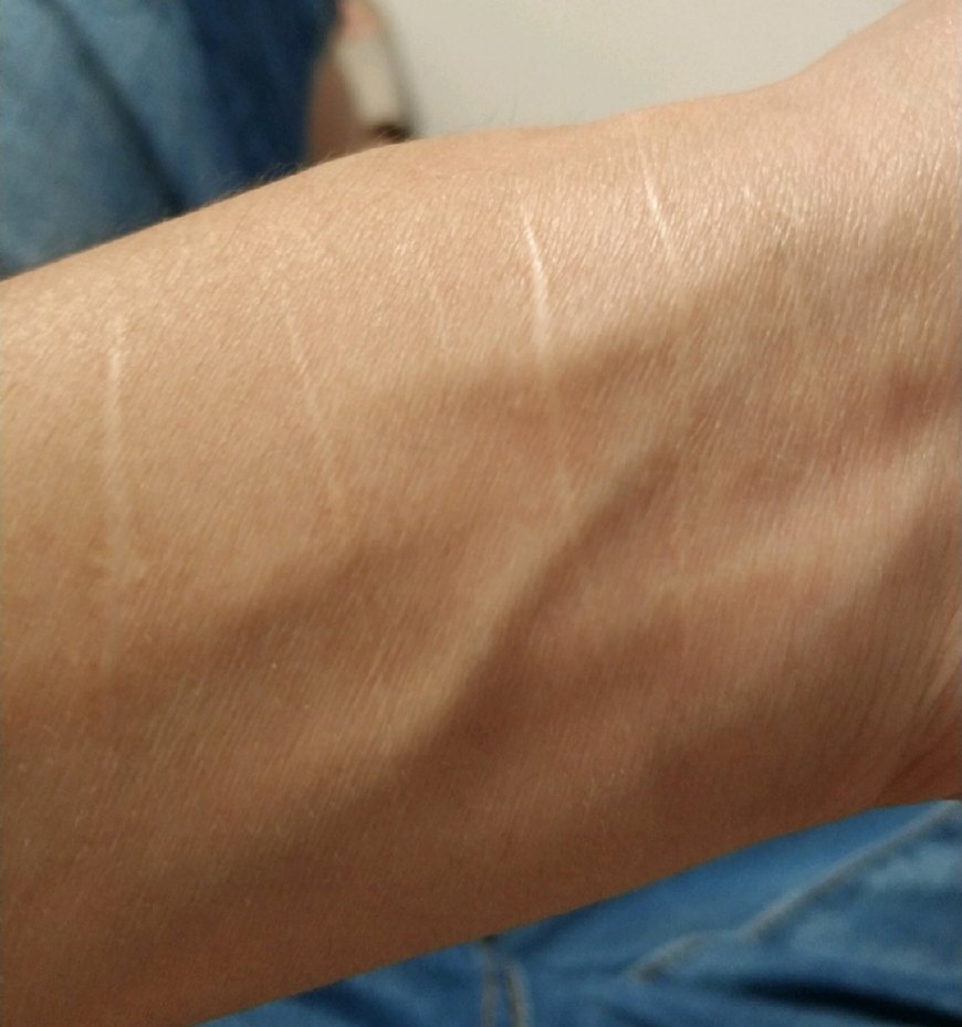 某工友想进富士康工作，却被告知身上有刀疤的不能收