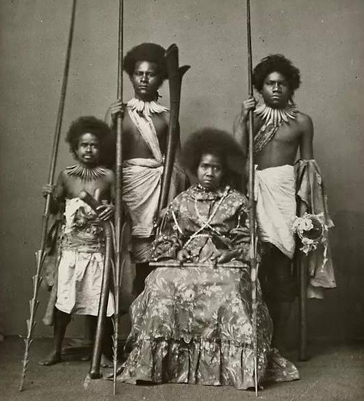 得了白化病的黑人，在百年前的美国，被迫出演畸形秀、被残忍猎杀