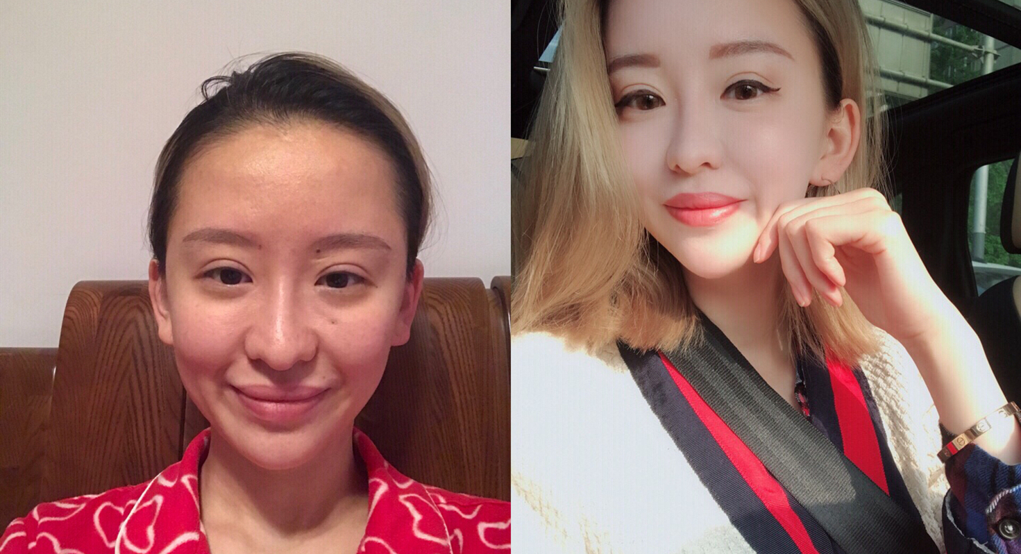 胶原蛋白如何补,胶原蛋白应该怎么补