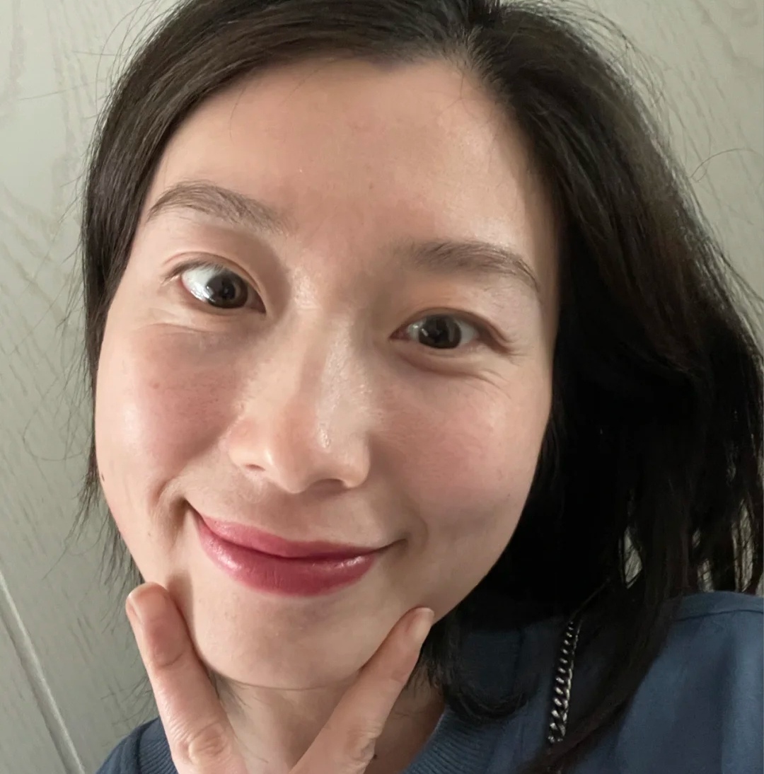 油性皮肤更抗衰老吗,油性皮肤保湿有用吗