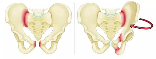 低价作饵、胸部按摩，视频曝光被深挖：这5个项目，害惨中国女人