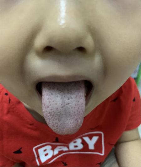 一岁半宝宝盗汗很严重怎么办,5岁孩子盗汗的原因和治疗方法