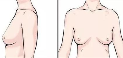 如何选择适合自己的内衣款式,如何选择适合自己的内衣图解