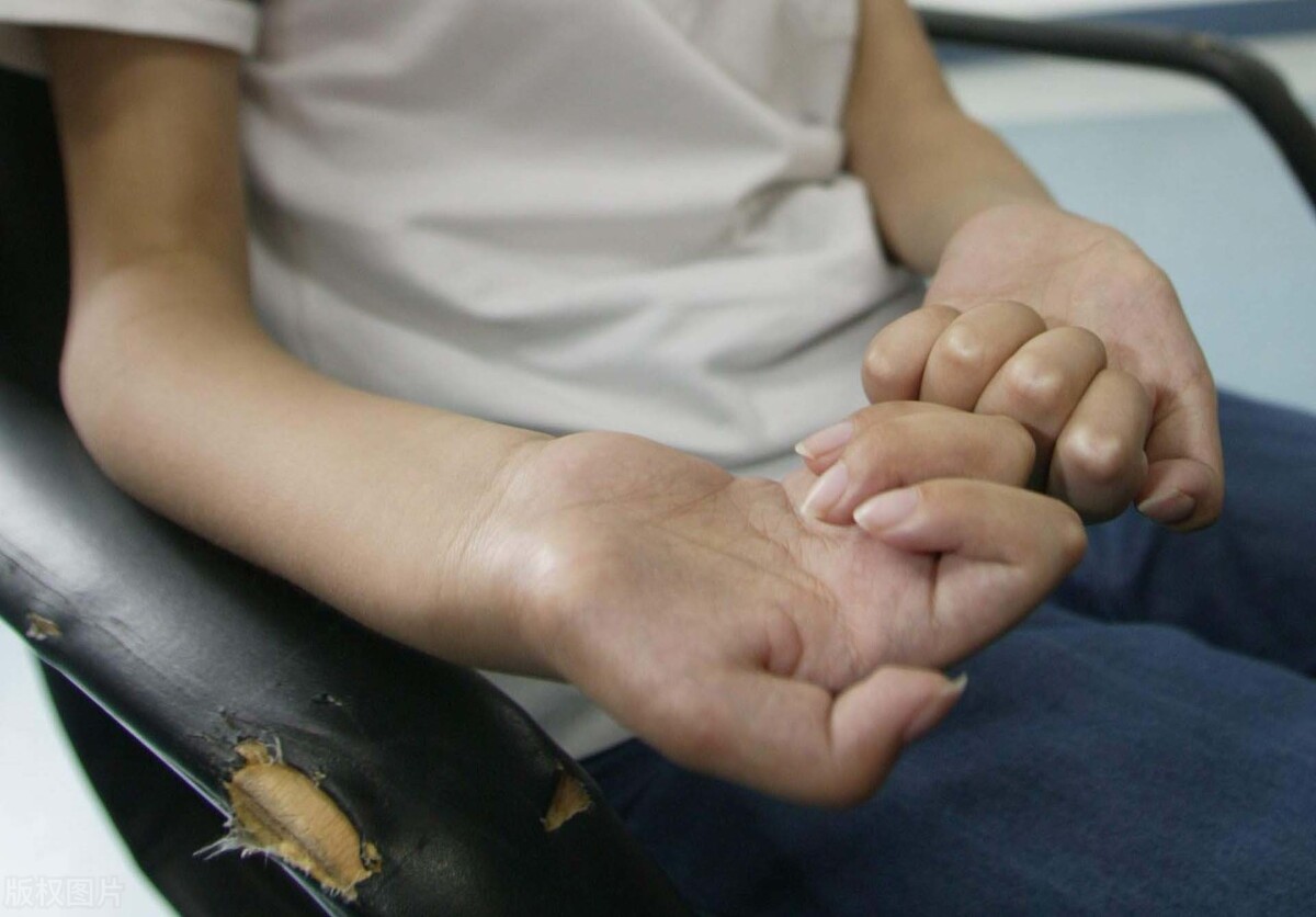 重症肌无力和肌肉萎缩的区别,肌肉萎缩与重症肌无力一样吗