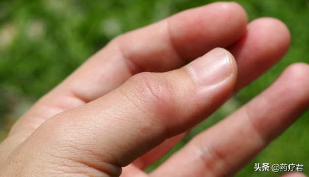 尿酸值从370忽然降到150,尿酸高达500吃什么药