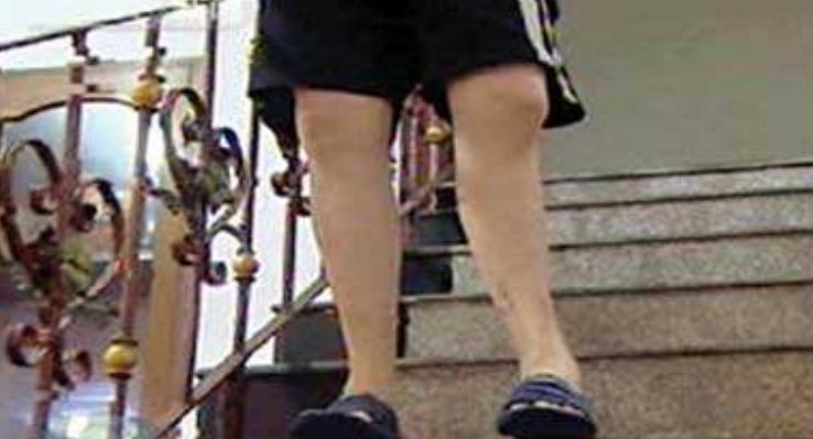 断骨长高李亚诺现状,中国断骨增高第一人李亚诺