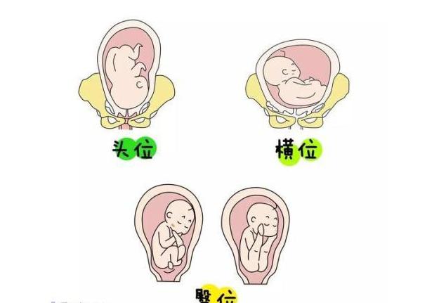 孕期8个月胎位臀位还能转过来吗,28周胎位臀位怎么纠正