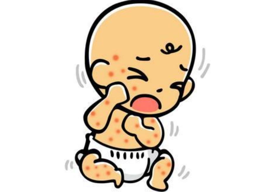 宝宝背后有疹子是什么疹子,宝宝出疹子会有什么疹子