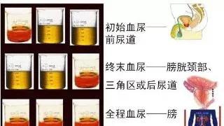 尿频尿急尿血反复发作女性,女性为什么会尿急尿频尿痛