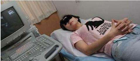 监测排卵最简单易行的方法,监测排卵的五个方法